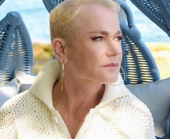 Boletim médico atualiza estado de Xuxa e revela previsão de alta - Metrópoles