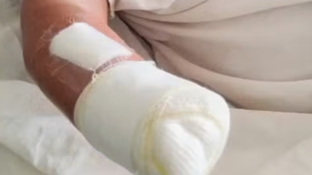 Mulher é atacada com foice e tem mão amputada pelo companheiro